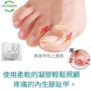 Alphax - Ingrown Nail Gel-Aid | 2 pieces | AP-439806 [Made in Japan] 